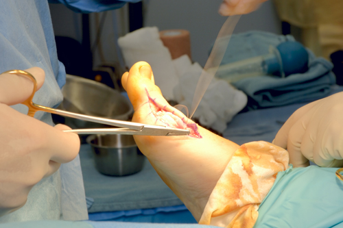Foot & Ankle Surgery